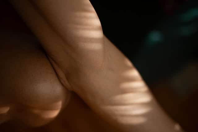 tratamiento para estrias